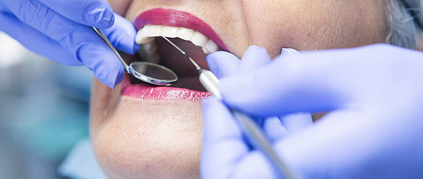 Best Emergency Wisdom Teeth Removal in Springfield, OH